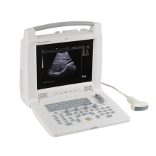 High Quality Durable Using Various Full Digital Portable Ultrasound Scanner